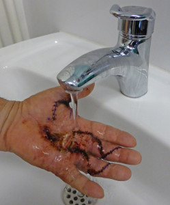 Le lavage de la plaie à l'eau courante du robinet est le meilleur moyen de nettoyer la plaie.