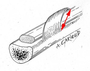 Largeur de la poulie après agrandissement
