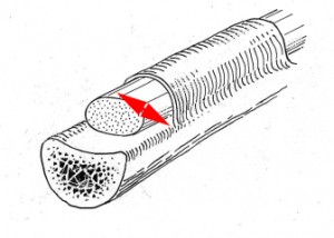 Largeur de la poulie avant agrandissement