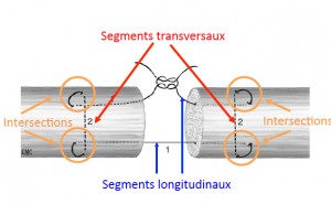schema-suture-tendons-flechisseurs